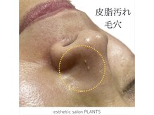 プランツ(PLANTS)/50代／１回／毛穴ケア