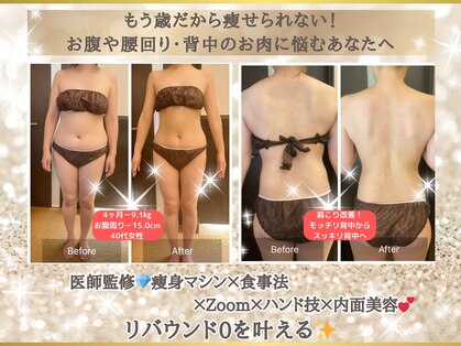 ウノジェンネ UNO DJENNEの写真