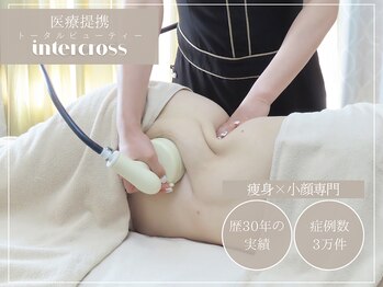 インタークロス(intercross)