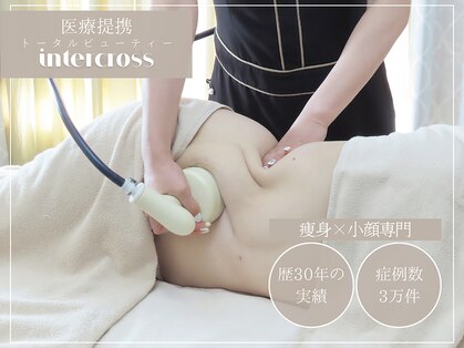 インタークロス(intercross)の写真
