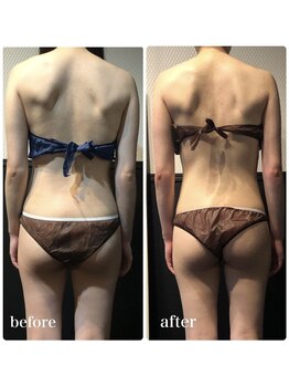 ピーラトゥ 日立(P-Ratu)/ブライダルコース