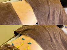 恵比寿駅前整骨院はり院 別館/腰痛　立ち仕事　