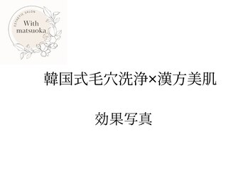 ウィズマツオカ 光の森店/韓国式毛穴洗浄＋漢方美肌 効果