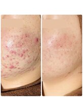 ビューティーホリック 蘇我店(BEAUTY HOLIC)/