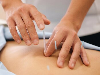 すずらん鍼灸接骨院 昭和橋通院 -肩こり・腰痛・骨盤矯正・整体・もみほぐし-の写真/慢性的な首肩こりに◎鍼灸×もみほぐしで深部までケアし、軽い体へ導きます。