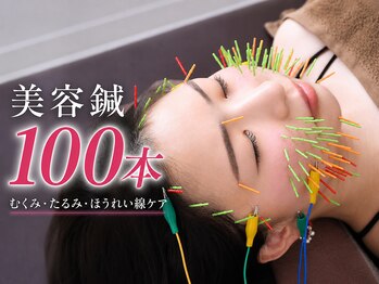 ソラナ(Solana)の写真/【上本町徒歩2分】美容鍼で肌質改善と小顔矯正♪《初めての方にもオススメ♪》大阪美容鍼灸/むくみ改善