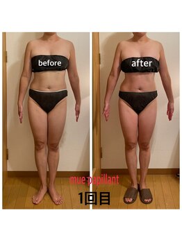 ミュー パピヤン(mue papillant)/ハイパーナイフEX&シェイプ全身