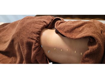 羅針堂鍼灸整体院 横浜鶴見店/マタニティの方への鍼灸