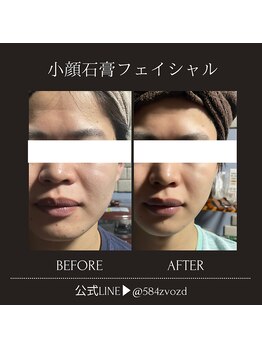 フィールグルック(Viel Gluck)/短期集中型の結果重視！