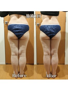 ヨサパーク サーナ 仙川(YOSA PARK Sana)/50代お客様ビフォー⇒アフター