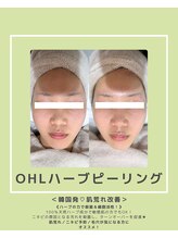 ソワナ(soina)/【神楽坂駅/フェイシャル/毛穴】