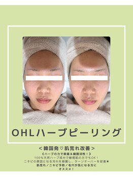 ソワナ(soina)/【神楽坂駅/フェイシャル/毛穴】