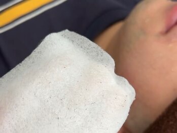 ボス 大曽根店(BOSS)/その場でポロッと抜けるヒゲ脱毛