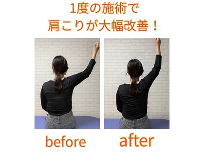 整体院京鍼(KYO-SHIN)の写真