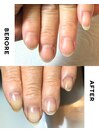 自爪育成奇跡のbefore after