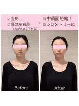 ビーホリック(Bholic)/