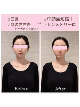 ビーホリック(Bholic)/