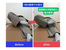 田中療術院 松江分院の雰囲気(股関節の固さは、慢性的な腰や膝の痛みにもつながります。)