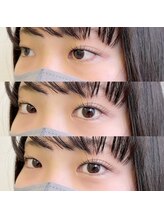 ティーラ(TiLLA)/