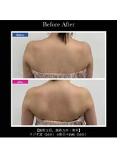 イデアール(ideal)/痩身★