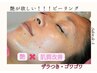 《ごわつき肌》をクリアに【乳酸ピーリング】ダウンタイムなし◎