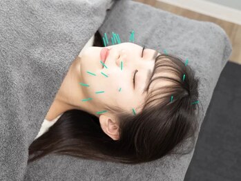 リベルテ(liberte)の写真/美容鍼灸は当院へご相談下さい♪お顔のむくみを改善し小顔効果☆専属スタッフ在籍で安心・圧倒的効果を◎