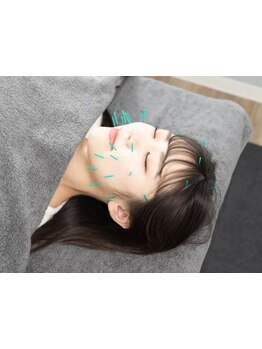 鍼灸施術を受けたい