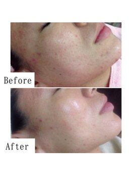 グラシア(gracia)/シミ・毛穴ケア専門店gracia