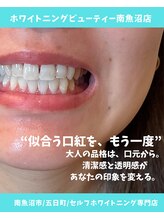 ホワイトニング ビューティー 南魚沼店(whitening beauty)/似合う口紅をもう一度！