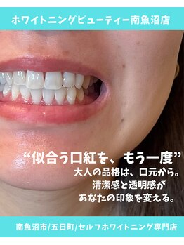 ホワイトニング ビューティー 南魚沼店(whitening beauty)/似合う口紅をもう一度！
