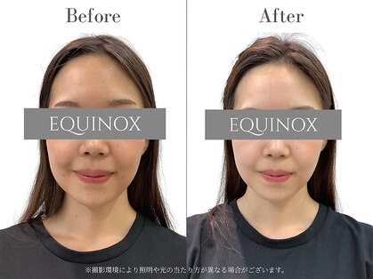 イクイノックス 錦糸町(EQUINOX)の写真