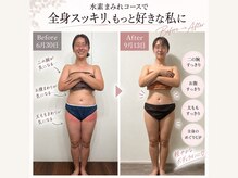 ヨサパーク ピオニー 二日市店(YOSA PARK Peony)の雰囲気（【水素まみれ90分コ－ス】スピード痩せならこのコ－ス）