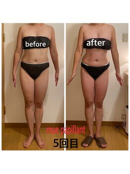 ミュー パピヤン(mue papillant)/ハイパーナイフEX&シェイプ全身