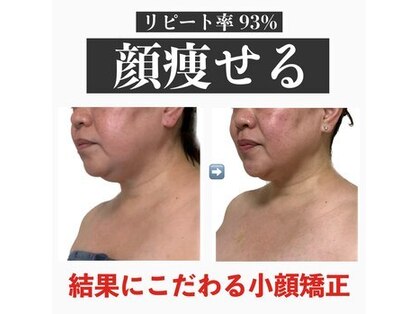 オーラ 美容サロン(AURA)の写真