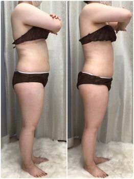 リンエステティック(凜ESTHETIC)/