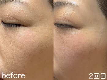 ハレオラ(HaleOla)/40代☆化粧しないほうが綺麗に♪