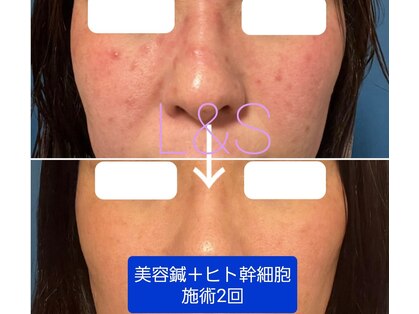 エルアンドエス(L&S)の写真