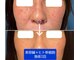 エルアンドエス(L&S)の写真