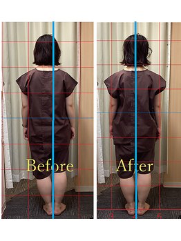 鍼灸 整体院 ひわたし/◇ゆがみのないきれいな姿勢へ！