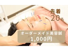 ハリ ヴァカンス(Hari Vacances)の雰囲気（グランドオープンキャンペーン実施中。美容鍼が20名様限定1000円）