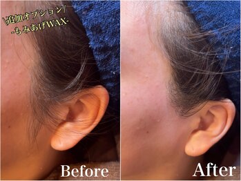 ジョエルワックス 沖縄那覇店(JOELLE WAX)/追加オプション★もみあげ脱毛！