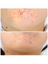 ビューティーホリック 蘇我店(BEAUTY HOLIC)/