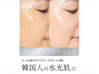 マインエム(mine.m)の写真/ドレス姿に、自信が持てる肌へ。
