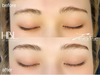 フェリーチェ(Felice)/HBLで眉毛の左右差改善
