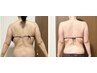 痩身コース→ウィンバックラジオ×漢方デトックスリンパ計120分