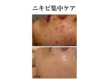 マーレン(Malen)の写真