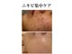 マーレン(Malen)の写真