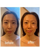 ディグニータココ 自由が丘(DIGNITA coco)/☆before after☆