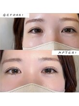 キウ(kiu.)/タレ目デザイン