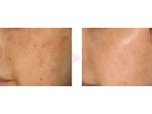 ノンノン(NonNon)/若々しい見た目へ